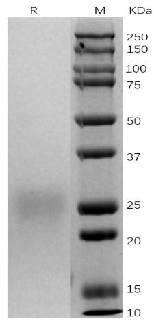巨噬细胞集落刺激因子2.jpg 巨噬细胞集落刺激因子2.jpg